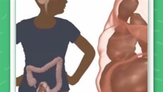 تخلیه مدفوع ناکامل