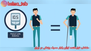 زخم پا دیابتی