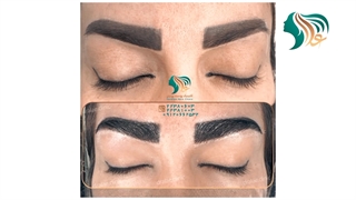یهترین روش کاشت ابرو