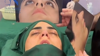 جراحی زیبایی بینی در اتاق عمل