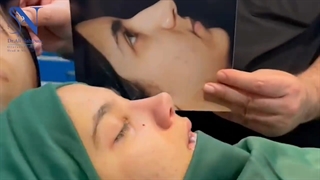جراحی زیبایی بینی