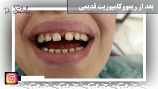 فیلم واقعی کامپوزیت ونیر برند سارمکو