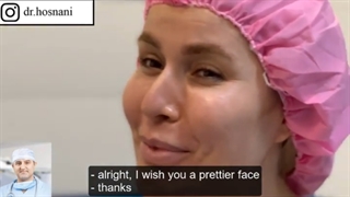 جراحی انحراف بینی