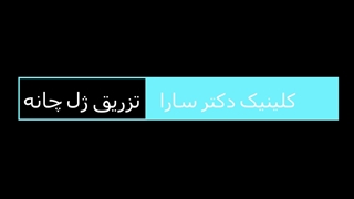 تزریق ژل چانه
