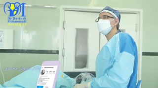 خرد کردن سنگ حالب با سنگ شکن