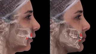 جراحی فک و ارتودنسی | دکتر داودیان