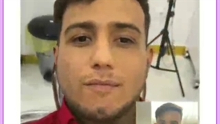 جراحی گوش برجسته یا لیفت گوش چیست ؟