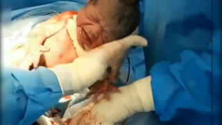 زایمان سالم بعد از سقط مکرر