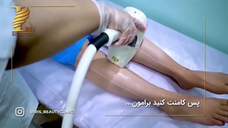 فیلم صفر تا صد لیزر موهای زائد با دستگاه اسکلپیون مدیواستار