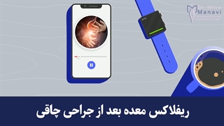 ریفلاکس و جراحی چاقی