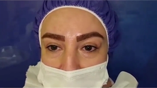 بلفاروپلاستی