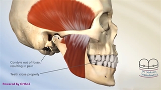 دردهای فک و ارتودنسی | دکتر احسان ابوئی مهریزی