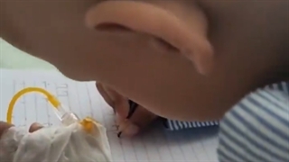 ایلیا پسر نازنین مبتلا به یویینگ سارکوم