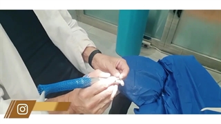 نظر بیمار فرانسوی درباره تجربه لمینت سرامیکی در کلینیک دندانپزشکی دکتر پورشاهی