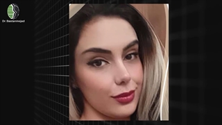 جراحی بینی با اصلاح افتادگی نوک و پره های بینی | دکتر باستانی نژاد