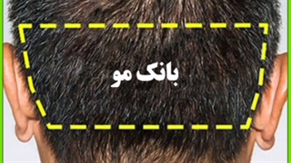 بانک مو و گرافت مو چیست؟