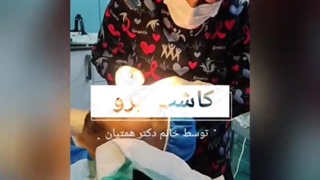 کاشت ابرو توسط خانم دکتر ناهید همتیان