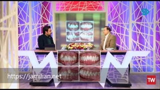 درمان عقب بودن فک بالا با ارتودنسی / متخصص ارتودنسی / دکتر جمیلیان