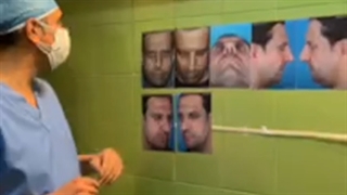 فیلم واقعی عمل بینی مردانه در اتاق عمل