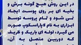 مزایای جراحی لاپاراسکوپی