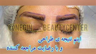 بلافاصله بعد از کاشت ابرو نگین گرگان 00336093000
