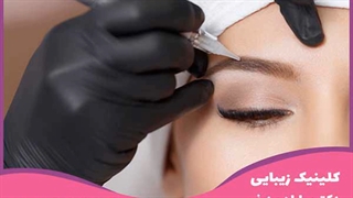 کاشت ابرو