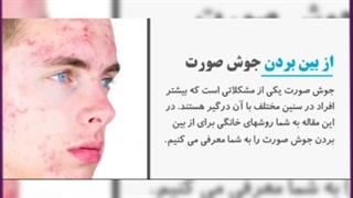 انواع جوش صورت و راهکار هایی معجزه آسا برای درمان آن