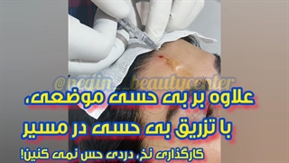 نخ لیفت ابرو، فیلم کامل و با توضحیات، ۰۹۳۳۶۰۹۳۰۰۰, گرگان