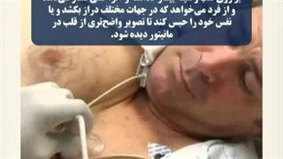 اکوکاردیوگرافی چیست؟