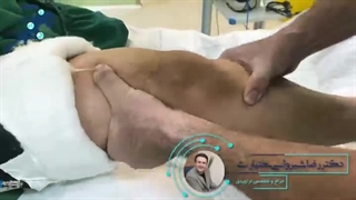 تست لاچمن| دکتر شیروانی بختیاری