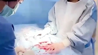 نحوه گرفتن خون بند ناف