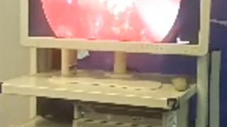 فیلم واقعی و بدون سانسور آندوسکوپی سینوس