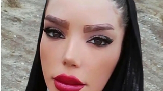 قبل وبعد از جراحی زیبایی بینی