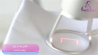 نکات لازم و ضروری بعد از لیزر روشن کننده
