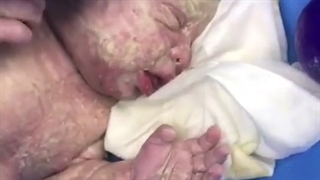 فیلم واقعی سزارین نوزاد حاصل آی وی اف