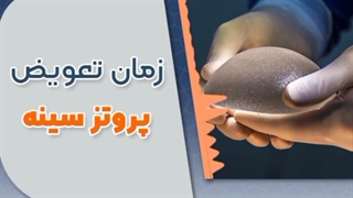 زمان تعویض پروتز سینه | دکتر محسن اسدی