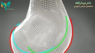 تجربه تعویض مفصل زانو