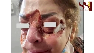تزریق ژل در آرایشگاه!!!!!
