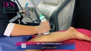 آب کردن چربی ساق پا