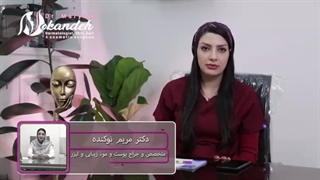 مهم تری نکات بعد از تزریق بوتاکس