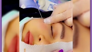 آنچه در مورد ژل آلیاکسین و ماندگاری آن مهم است بدانید!