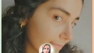 رضایت بیمار از جراحی بینی توسط دکتر کیانا کیا