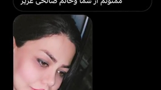 ۱۰ ماه بعد از جراحی زیبایی بینی