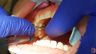 آسیب های ایاتروژنیک