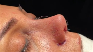 فیلم واقعی و بدون سانسور عمل بینی گوشتی