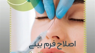 اصلاح فرم بینی با تزریق فیلر