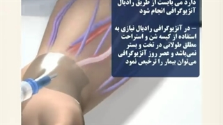 تفاوت آنژیوگرافی از دست و پا