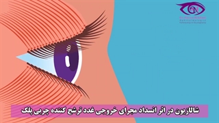 جراحی شالازیون