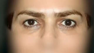 فیلم واقعی جراحی پلک