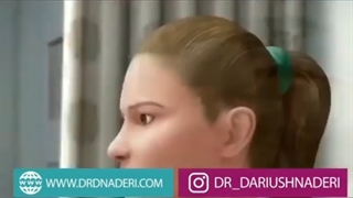 فرم بینی بعد از جراحی